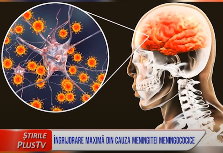 ÎNGRIJORARE MAXIMĂ DIN CAUZA MENINGITEI MENINGOCOCICE